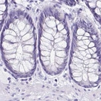 Immunohistochemical staining of human colon using Anti-SRL antibody HPA041535.