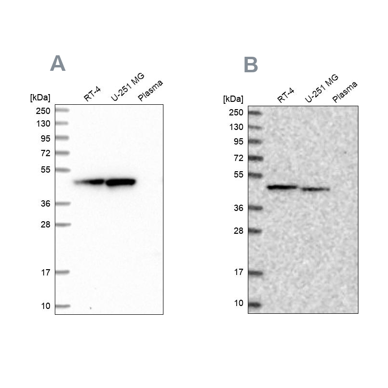 Anti-PAICS Antibody