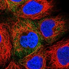 Immunofluorescent staining of human cell line HEK 293 shows localization to cytosol.