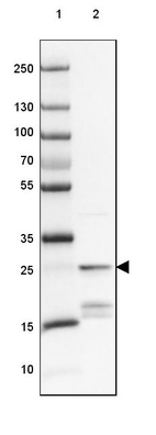 Anti-PPP1R1A Antibody