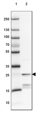 Lane 1: Marker [kDa] 250, 130, 100, 70, 55, 35, 25, 15, 10_br/_Lane 2: Human Skeletal muscle tissue