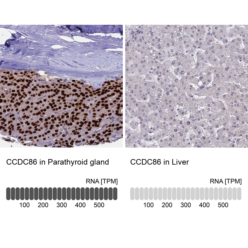 Anti-CCDC86 Antibody
