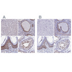 Immunohistochemical staining of human liver, prostate, squamous epithelia and testis using Anti-CCDC86 antibody HPA041540 (A) shows similar protein distribution across tissues to independent antibody HPA041117 (B).