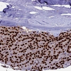 Immunohistochemical staining of human Parathyroid gland shows strong nuclear positivity in glandular cells.