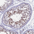 Immunohistochemical staining of human Testis shows moderate nuclear positivity in cells in seminiferous ducts and leydig cells.