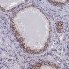 Immunohistochemical staining of human Prostate shows moderate nuclear positivity in glandular cells.