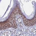 Immunohistochemical staining of human Skin shows moderate nuclear positivity in squamous epithelial cells.