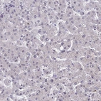Immunohistochemical staining of human liver shows very weak nuclear positivity in hepatocytes.