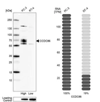 Western blot analysis in human cell line PC-3 and human cell line RT-4.