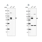Western blot analysis using Anti-CCDC86 antibody HPA041540 (A) shows similar pattern to independent antibody HPA041117 (B).