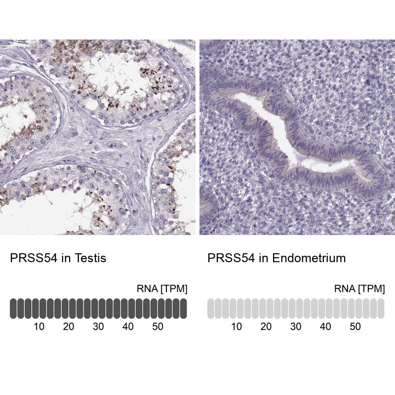 Anti-PRSS54 Antibody