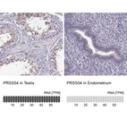 Anti-PRSS54 Antibody