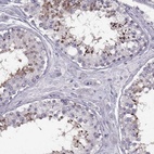 Immunohistochemical staining of human testis shows high expression.