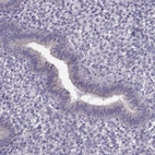 Immunohistochemical staining of human endometrium shows low expression as expected.