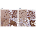 Anti-KARS Antibody