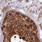 Immunohistochemical staining of human testis shows strong cytoplasmic positivity in cells in seminiferous ducts.