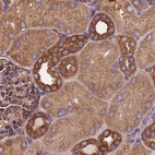 Immunohistochemical staining of human kidney shows strong cytoplasmic positivity in cells in tubules.