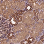 Anti-KARS Antibody