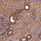 Immunohistochemical staining of human kidney shows strong cytoplasmic positivity in cells in tubules.