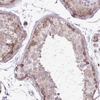 Immunohistochemical staining of human testis shows moderate membranous positivity in cells in seminiferous ducts.