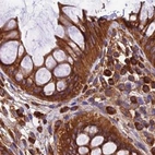 Immunohistochemical staining of human colon shows strong cytoplasmic positivity in glandular cells.
