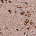 Immunohistochemical staining of human cerebral cortex shows strong cytoplasmic positivity in neuronal cells.