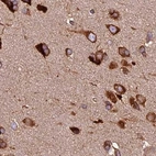 Immunohistochemical staining of human cerebral cortex shows strong cytoplasmic positivity in neuronal cells.