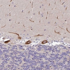 Immunohistochemical staining of human cerebellum shows strong cytoplasmic positivity in Purkinje cells.