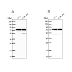 Anti-KARS Antibody