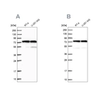 Western blot analysis using Anti-KARS antibody HPA041550 (A) shows similar pattern to independent antibody HPA041345 (B).