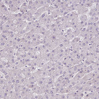 Immunohistochemical staining of human liver shows no positivity in hepatocytes as expected.