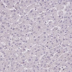 Immunohistochemical staining of human liver shows no positivity in hepatocytes as expected.