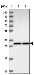 Lane 1: Marker [kDa] 250, 130, 95, 72, 55, 36, 28, 17, 10_br/_Lane 2: Human cell line RT-4_br/_Lane 3: Human cell line U-251 MG
