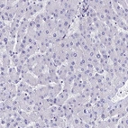 Immunohistochemical staining of human liver shows low expression as expected.