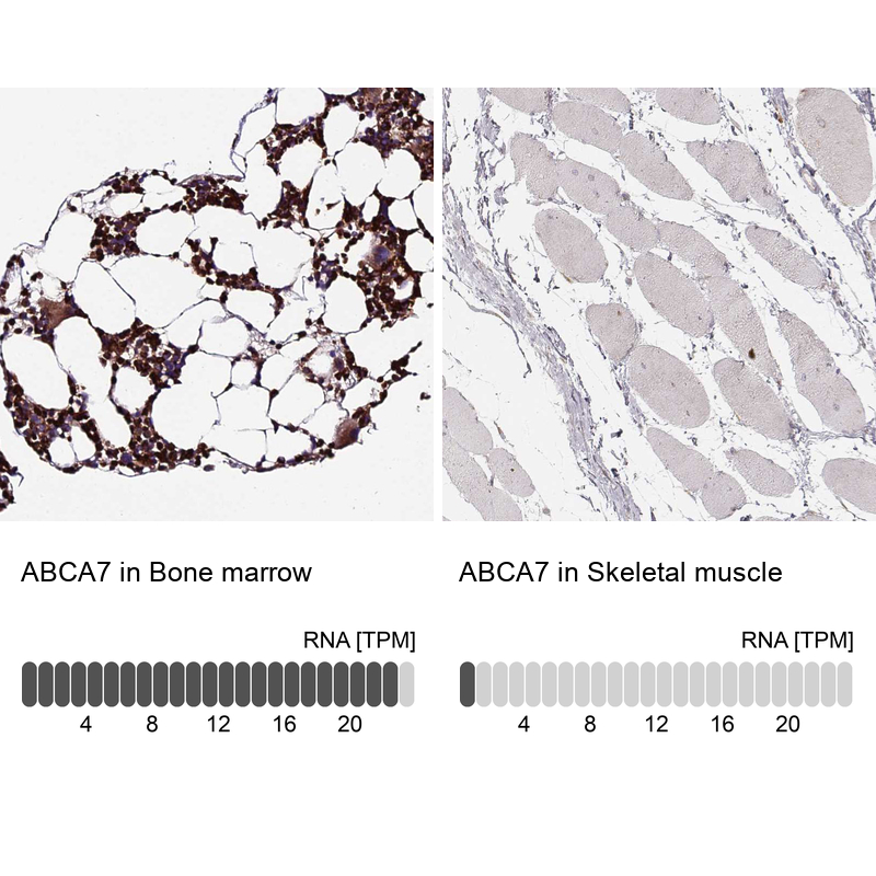 Anti-ABCA7 Antibody
