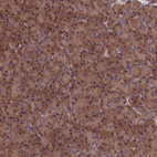 Immunohistochemical staining of human pancreas shows strong cytoplasmic positivity in exocrine glandular cells.