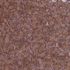Immunohistochemical staining of human pancreas shows strong cytoplasmic positivity in exocrine glandular cells.