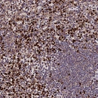Immunohistochemical staining of human spleen shows strong cytoplasmic positivity in a subset of cells in red pulp.