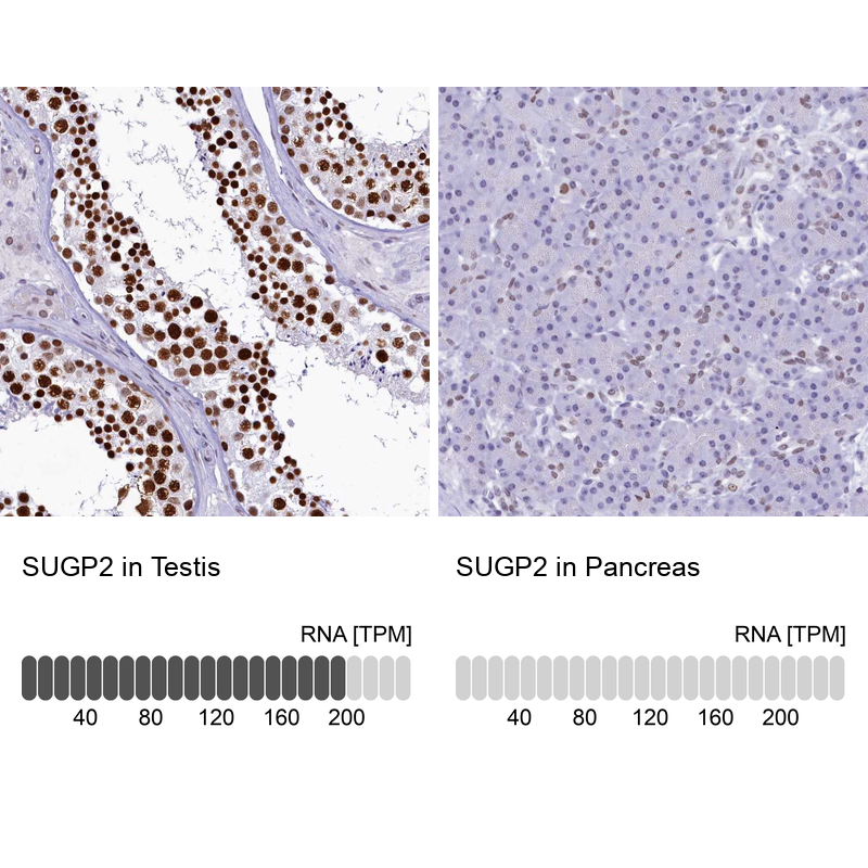 Anti-SUGP2 Antibody