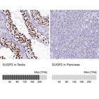 Anti-SUGP2 Antibody