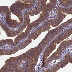 Immunohistochemical staining of human fallopian tube shows moderate cytoplasmic positivity in glandular cells.