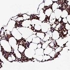 Immunohistochemical staining of human bone marrow shows strong cytoplasmic positivity in hematopoietic cells.