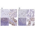 Immunohistochemical staining of human cerebral cortex, kidney, lymph node and testis using Anti-SUGP2 antibody HPA041557 (A) shows similar protein distribution across tissues to independent antibody HPA061111 (B).