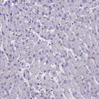 Immunohistochemical staining of human liver shows no positivity in hepatocytes as expected.