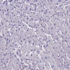 Immunohistochemical staining of human liver shows no positivity in hepatocytes as expected.