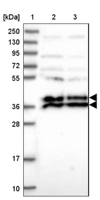 Lane 1: Marker [kDa] 250, 130, 95, 72, 55, 36, 28, 17, 10_br/_Lane 2: Human cell line RT-4_br/_Lane 3: Human cell line U-251MG sp