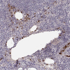 Immunohistochemical staining of human lymph node shows moderate positivity in lymphoid cells.