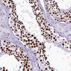 Immunohistochemical staining of human testis shows high expression.