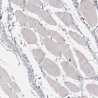 Immunohistochemical staining of human skeletal muscle shows no positivity in myocytes as expected.