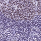 Immunohistochemical staining of human lymph node using Anti-SUGP2 antibody HPA041557.